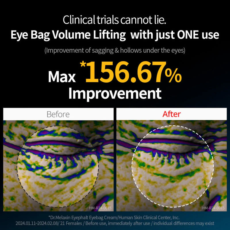 Eyephalt Eyecream